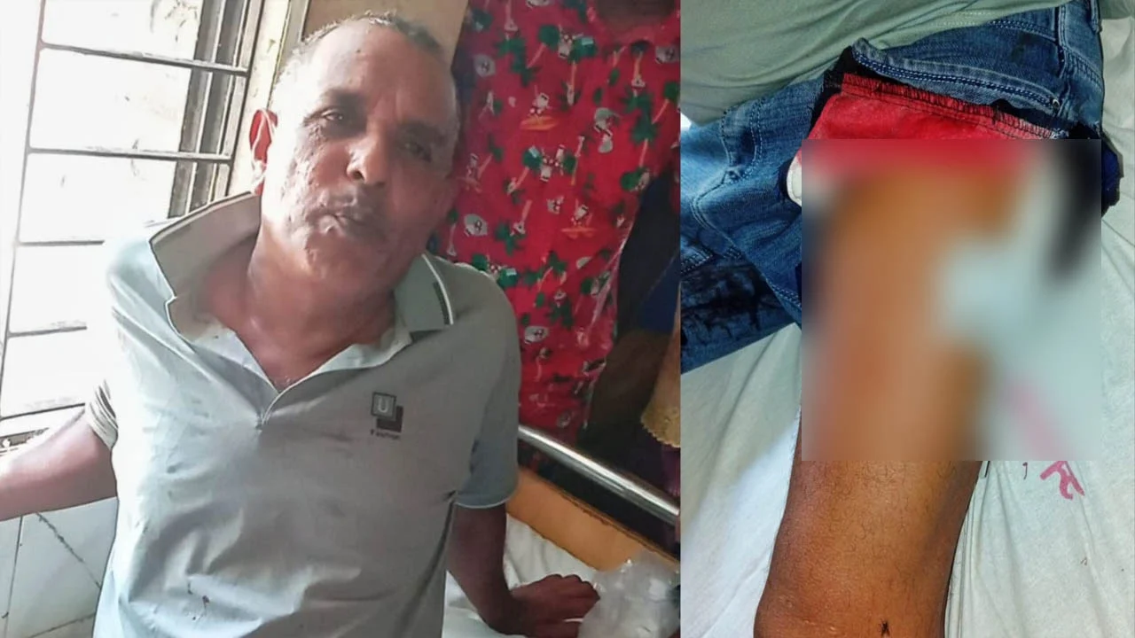ঈশ্বরদীতে প্যানেল চেয়ারম্যানকে ধারালো অস্ত্রে আঘাত, এলাকায় আতঙ্ক
