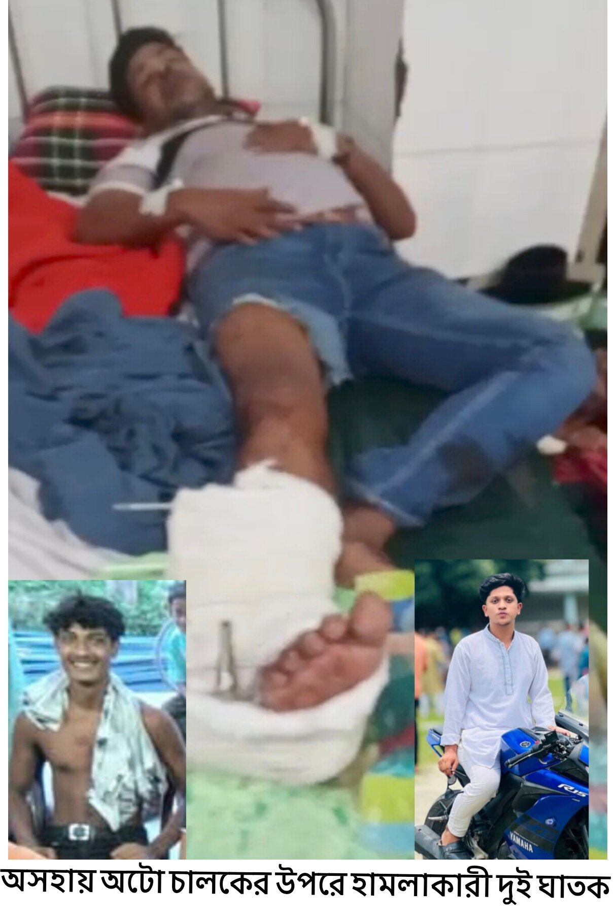 ফরিদগঞ্জে অটো চালককে চাপাতি দিয়ে কুপিয়ে জখমের অভিযোগ, ঢাকার পঙ্গু হাসপাতালে চিকিৎসাধীন; গ্রেপ্তার ১